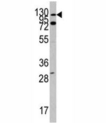 c-Abl Antibody (ABL1)