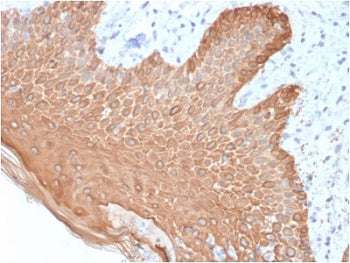 Multi Cytokeratin Antibody
