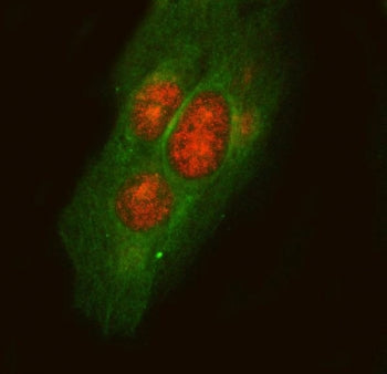 PLA2G15 Antibody / LPLA2 / LLPL