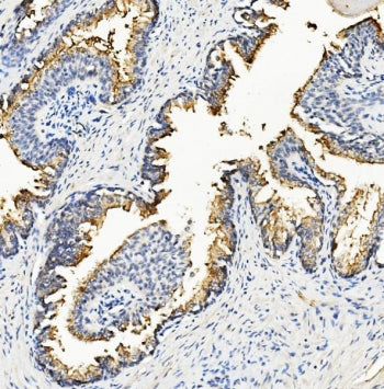 Ribonuclease Inhibitor Antibody / RNH1