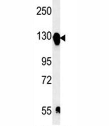 Integrin alpha 5 Antibody