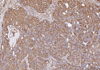 Calmegin Antibody / CLGN