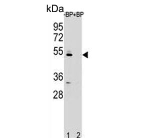 ZDHHC2 Antibody / REAM / ZNF372