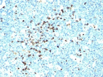 IgG Heavy Chain Antibody Cocktail