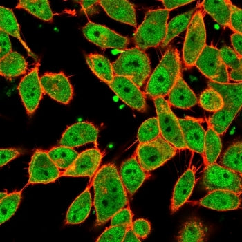 Immunofluorescent staining of PFA-fixed human HeLa cells using MLX antibody (green, clone PCRP-MLX-1