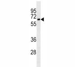 CD25 Antibody