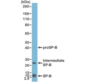 SP-B Antibody / Surfactant protein B