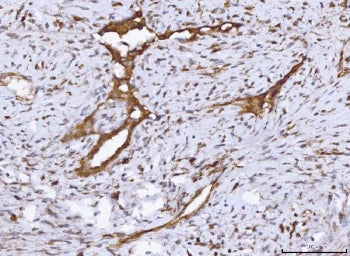 COX1 Antibody