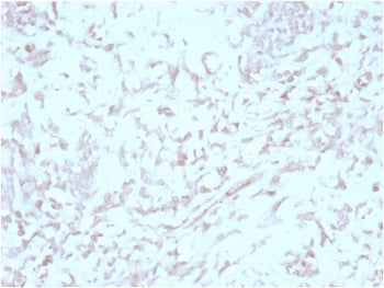 IHC staining of FFPE human liver tissue with Kindlin 2 antibody (clone 3A3). HIER: boil tissue secti