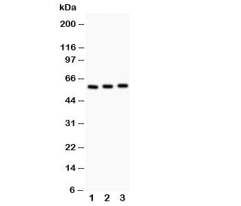 Western blot testing of CYP11A1 antibody and Lane 1: rat testis; 2: mouse testis; 3: mouse brain; Ex