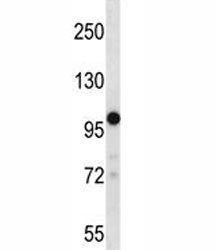 TRPM4 antibody western blot analysis in 293 lysate. Predicted molecular weight: 116/134/119 kDa,(TRP