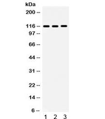 Western blot testing of 1) human 22RV1, 2) RH35 and 3) mouse NIH3T3 lysate with NLRC4 antibody. Expe