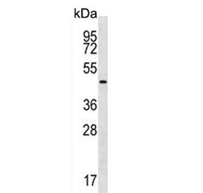 Gastric Intrinsic Factor Antibody / GIF / CBLIF
