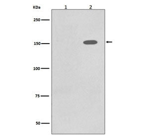 Phospho-EGF Receptor / EGFR Antibody (pY1086)