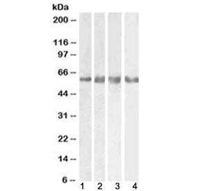 GABA A Receptor gamma 2 Antibody / GABRG2