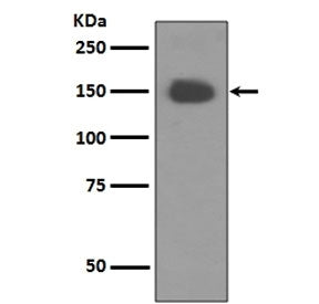TrkA Antibody / NTRK1