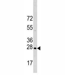 HSP27 Antibody