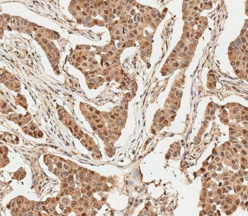 Ubiquitin Antibody