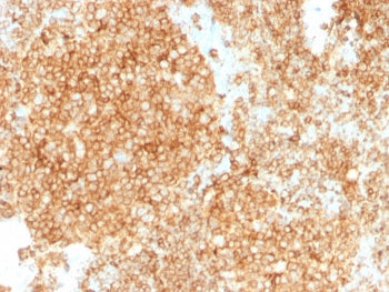 CD45 Antibody Cocktail (Leukocyte marker)