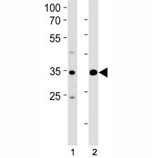 ATF4 Antibody