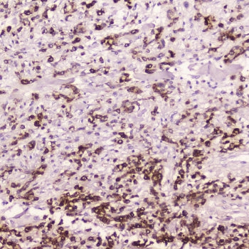 Cathepsin E Antibody / CTSE