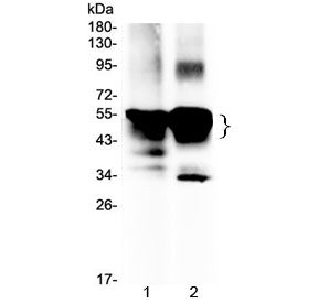 Retinal S antigen Antibody / SAG