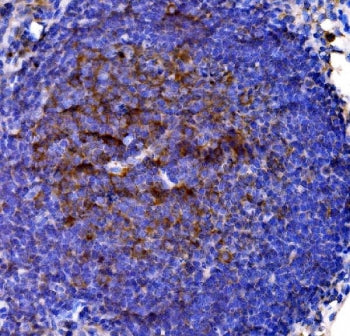 IHC staining of FFPE rat lymph node tissue with Cd38 antibody. HIER: boil tissue sections in pH8 EDT