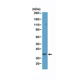 Western blot testing of human T-cell lysate with recombinant CD8a antibody at 1:100 dilution. Expect