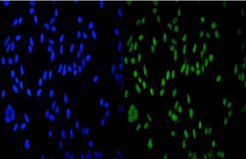 HDAC9 Antibody