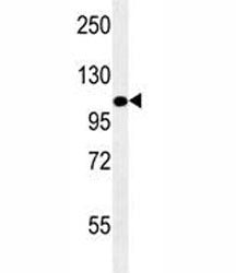 LAMP2 Antibody