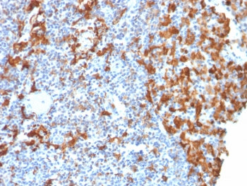IBA1 Antibody / AIF-1
