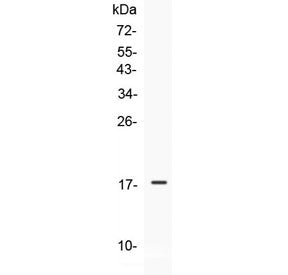 IL-25 Antibody / IL-17E