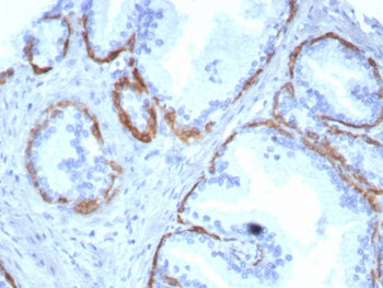 Cytokeratin 14 Antibody / CK14 / KRT14