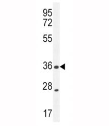 XCR1 Antibody