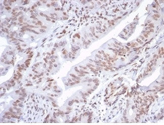ATRX Antibody / RAD54