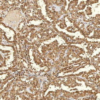 FAM60A Antibody / SINHCAF