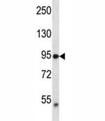 TRPV2 Antibody