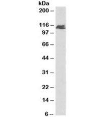 BMPR2 Antibody