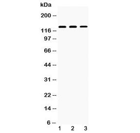 Western blot testing of 1) rat kidney, 2) mouse kidney and 3) human 293T lysate with Nephrin antibod