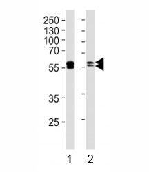 Western blot analysis of lysate from 1) A431 and 2) Raji cell line using LYN antibody. Predicted mol