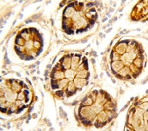 Platelet-derived growth factor receptor-like protein Antibody (PDGFRL)
