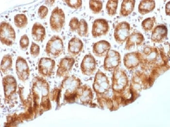 IHC testing of FFPE mouse colon tissue with b-Catenin antibody (clone CTNNB1/1509). Required HIER: b