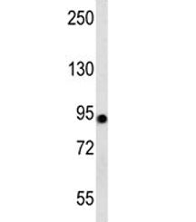 Aconitase 2 Antibody