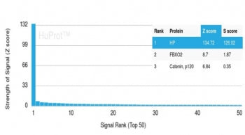 Analysis of a HuProt(TM) microarray containing more than 19,000 full-length human proteins using HP 