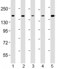 Western blot testing of human 1) K562, 2) Jurkat, 3) HeLa, 4) rat C6 and 5) human MOLT-4 cell lysate