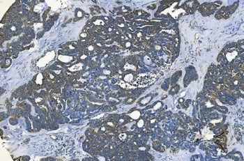 GABARAP Antibody