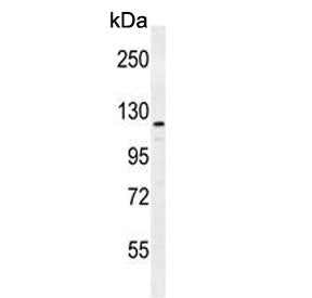 Western blot testing of human MDA-MB-231 cell lysate with ADAMTS18 antibody. Predicted molecular weight ~135 kDa.