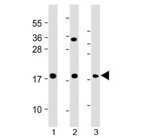 GPX7 Antibody (Center Region)