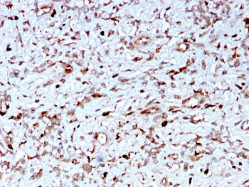 IHC staining of FFPE human liver with C1QA antibody. HIER: boil tissue sections in pH 9 10mM Tris wi