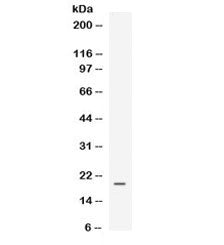 Western blot testing of human MCF7 cell lysate with EG-VEGF antibody. Expected molecular weight ~12 